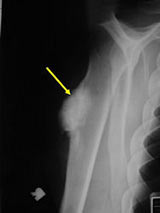 AP/scapular Y view radiograph: