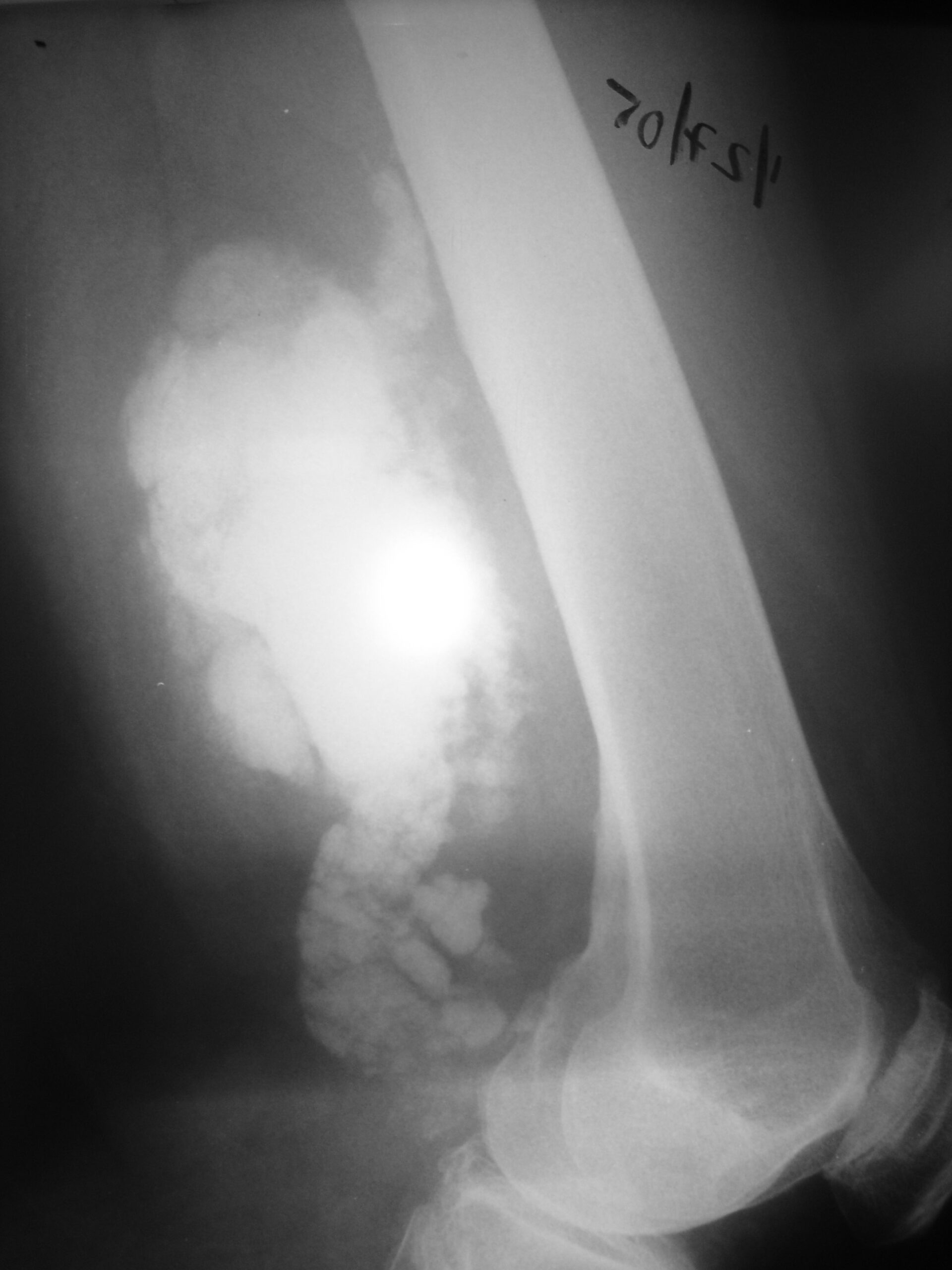 Fig. 2 Fig. 2