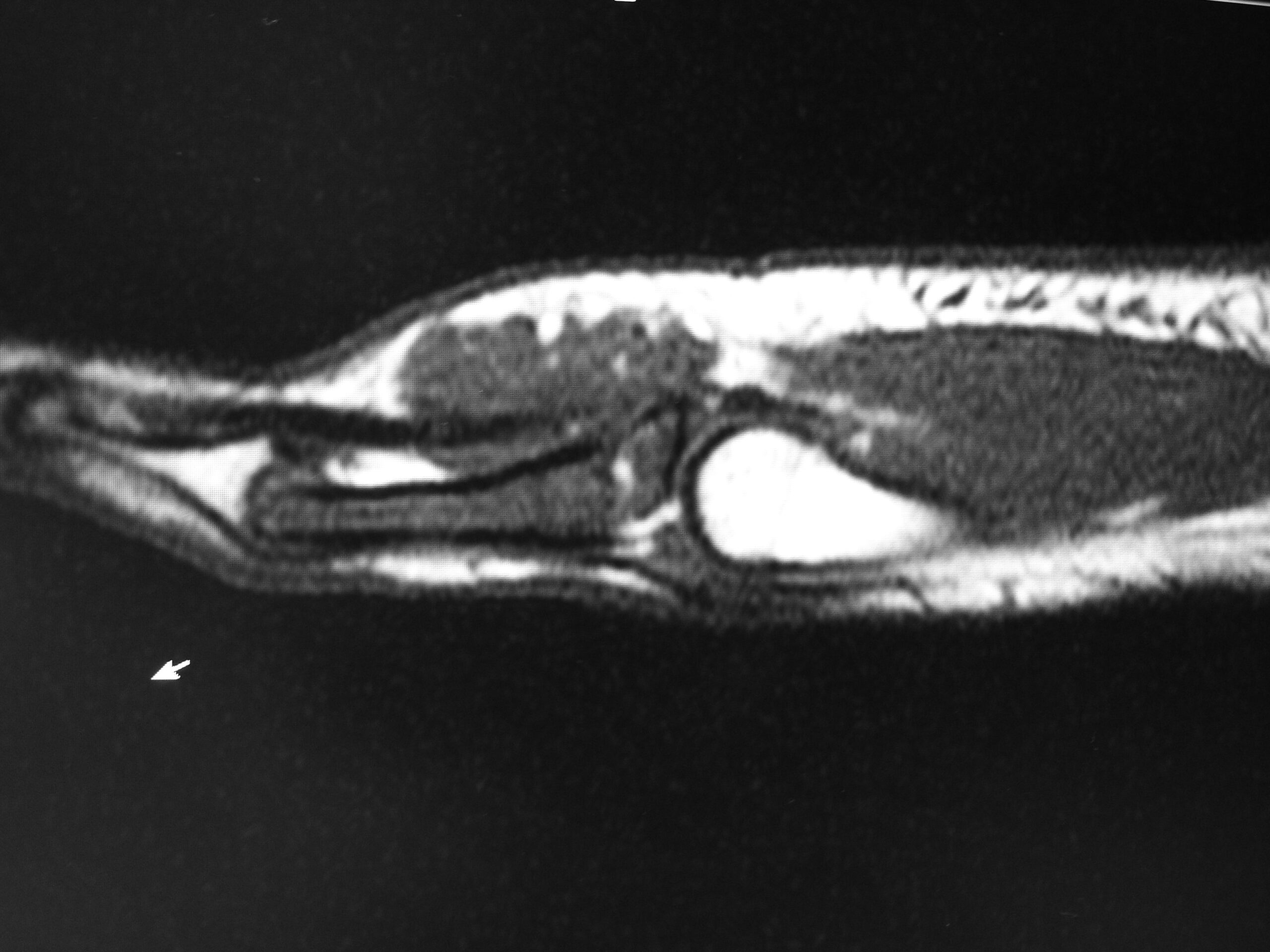 Fig. 3 Fig. 3