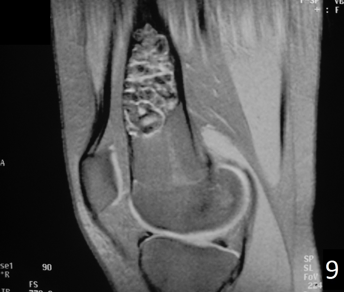 Fig. 9 Fig. 9