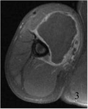 Fig. 3 Fig. 3