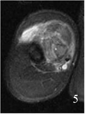 Fig. 5 Fig. 5