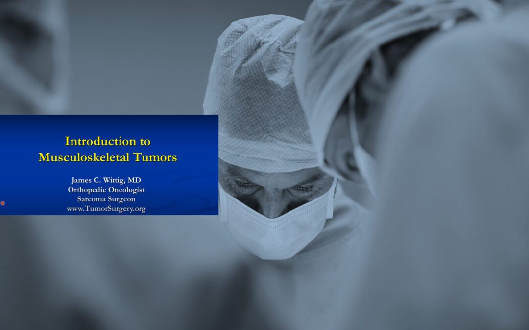 Musculoskeletal Tumors: Symptoms, Diagnosis, and Treatment