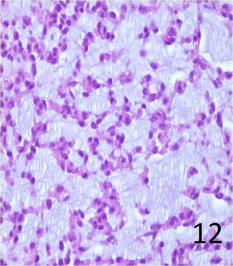 Fig. 12
