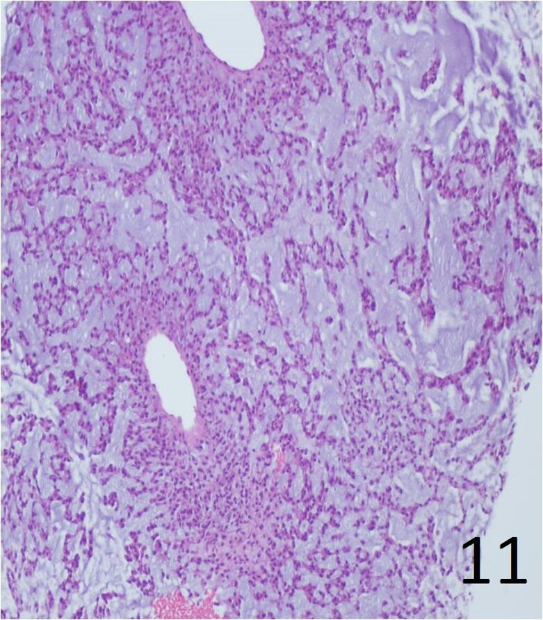 Fig. 11